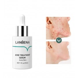 Сироватка для обличчя Lanbena Acne Treatment Serum проти акне та темних плям, 30 мл