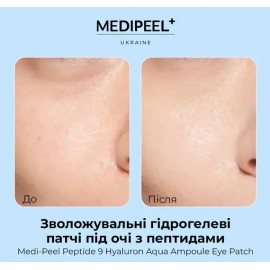 Зволожувальні гідрогелеві патчі під очі з пептидами MEDIPEEL Peptide 9 Hyaluron Aqua Ampoule Eye Patch, 60 шт