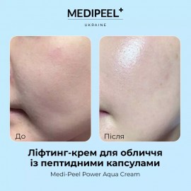 Ліфтинг-крем для обличчя із пептидними капсулами MEDIPEEL Power Aqua Cream, 50 мл